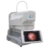 Keng maydon fundus fotosurati